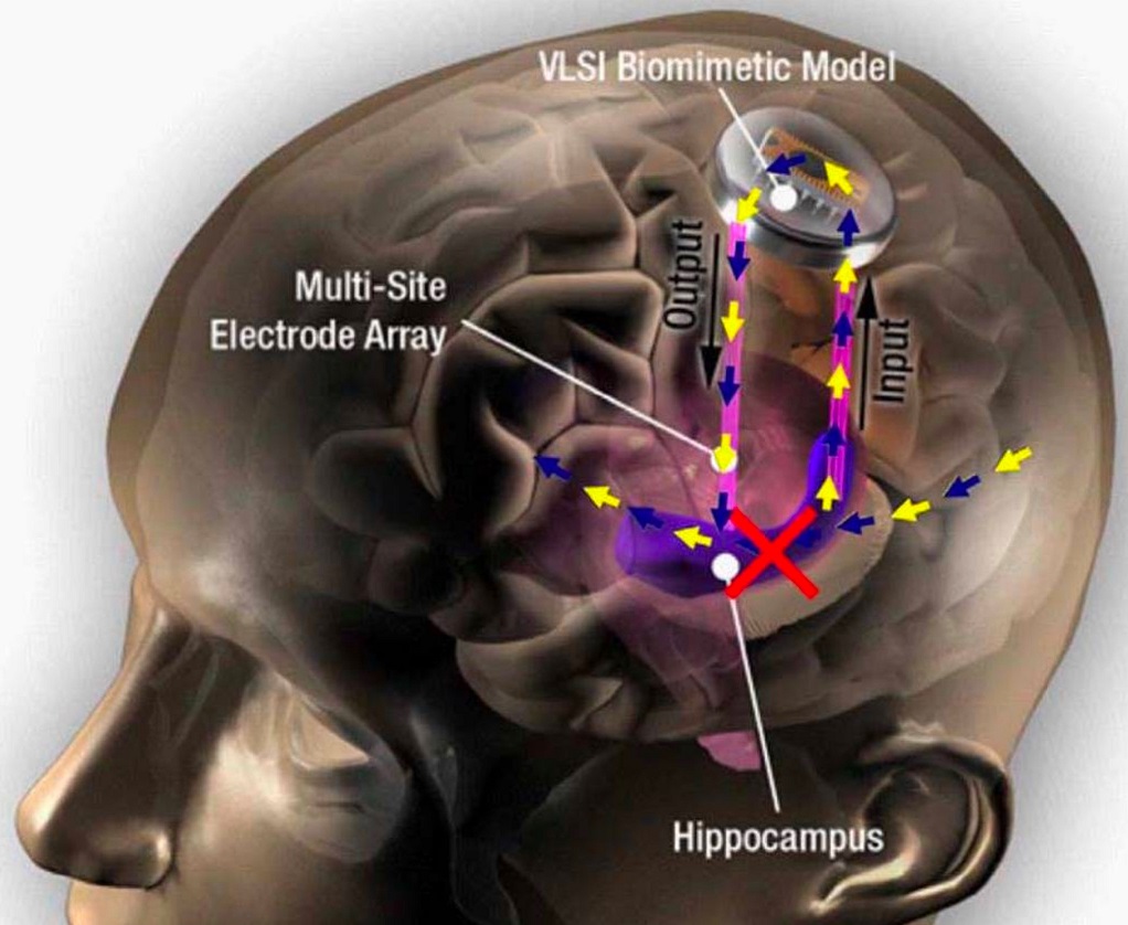 hippocampus-memory-prosthesis.smaller.jpg